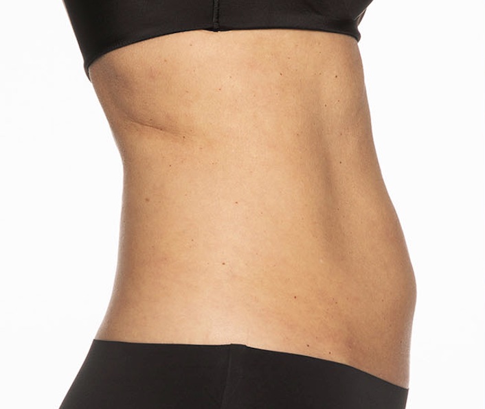 Before and after body sculpting Results Images | BodySculpt Labs By Sakoon in Omaha NE